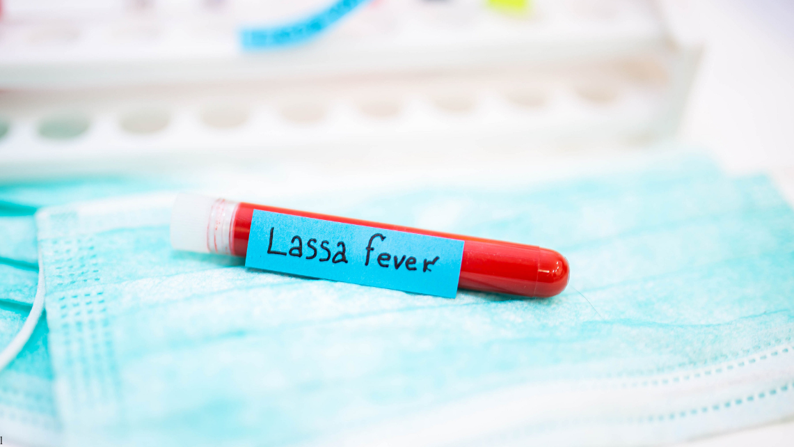 Test tube filled with blood labeled “Lassa fever” resting on a surgical mask, symbolizing laboratory research and diagnostic work focused on the viral disease