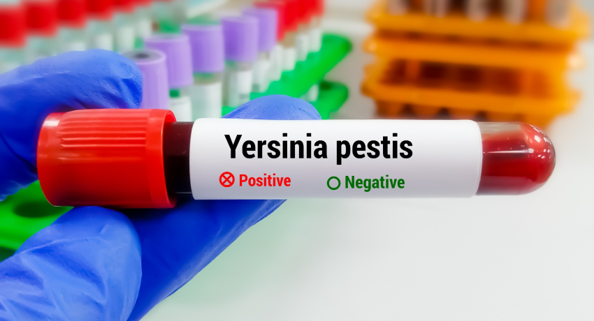 Gloved hand holding a blood sample tube labeled “Yersinia pestis,” with “Positive” marked and “Negative” unmarked; laboratory test tubes and racks are visible in the background.