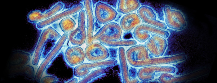 Color‑enhanced microscope image showing many small, tube‑shaped cells grouped closely together, highlighted in blue and orange against a dark background
